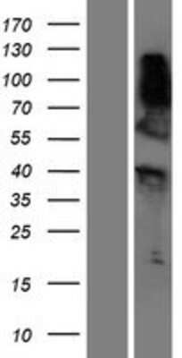 Western Blot: RNF165 Overexpression Lysate (Adult Normal) [NBP2-05363] Left-Empty vector transfected control cell lysate (HEK293 cell lysate); Right -Over-expression Lysate for RNF165.