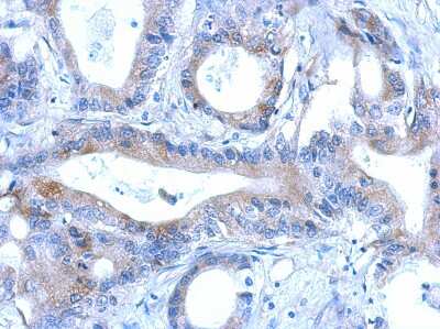 Immunohistochemistry-Paraffin RNF166 Antibody
