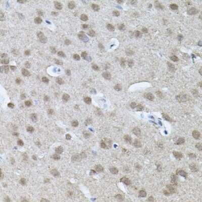 Immunohistochemistry-Paraffin RNF166 Antibody - BSA Free