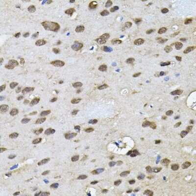 Immunohistochemistry-Paraffin RNF166 Antibody - BSA Free