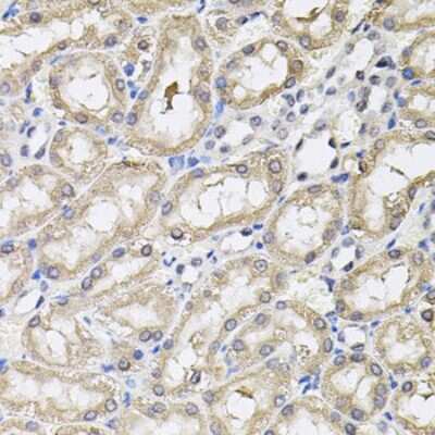 Immunohistochemistry-Paraffin RNF166 Antibody - BSA Free