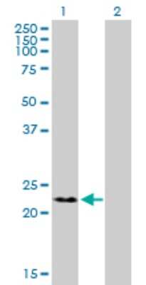 Western Blot: RNF166 Antibody [H00115992-B01P] - Analysis of RNF166 expression in transfected 293T cell line by RNF166 polyclonal antibody.  Lane 1: RNF166 transfected lysate(26.07 KDa). Lane 2: Non-transfected lysate.