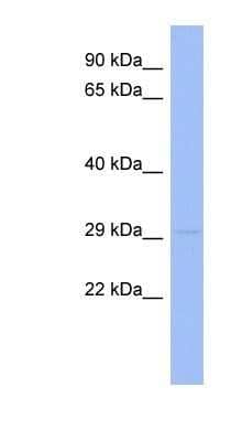 Western Blot: RNF166 Antibody [NBP1-80432] - Titration: 0.2-1 ug/ml, Positive Control: THP-1 cell lysate.