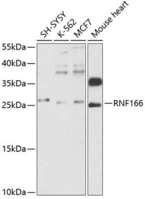 Western Blot: RNF166 Antibody [NBP2-93119] - Analysis of extracts of various cell lines, using RNF166 . Exposure time: 15s.