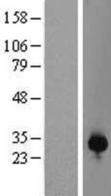 Western Blot: RNF166 Overexpression Lysate (Adult Normal) [NBL1-15433] Left-Empty vector transfected control cell lysate (HEK293 cell lysate); Right -Over-expression Lysate for RNF166.