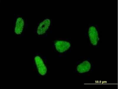 Immunocytochemistry/Immunofluorescence: RNF168 Antibody [H00165918-B01P] - Analysis of purified antibody to RNF168 on HeLa cell. (antibody concentration 10 ug/ml)