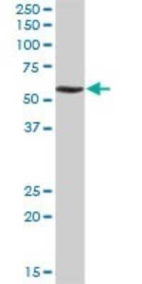 Western Blot: RNF168 Antibody [H00165918-D01P] - Analysis of RNF168 expression in human liver.