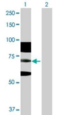 Western Blot: RNF168 Antibody [H00165918-D01P] - Analysis of RNF168 expression in transfected 293T cell line by RNF168 polyclonal antibody.Lane 1: RNF168 transfected lysate(65.00 KDa).Lane 2: Non-transfected lysate.