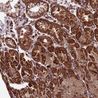 Immunohistochemistry-Paraffin RNF17 Antibody