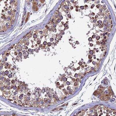 Immunohistochemistry-Paraffin: RNF17 Antibody [NBP1-83783] - Staining of human testis shows strong cytoplasmic positivity in cells in seminiferus ducts.