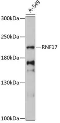 Western Blot: RNF17 Antibody [NBP2-94677] - Analysis of extracts of A-549 cells, using RNF17 .Exposure time: 90s.