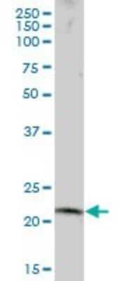 Western Blot RNF170 Antibody - Azide and BSA Free
