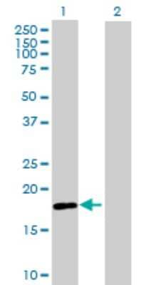 Western Blot RNF170 Antibody - Azide and BSA Free