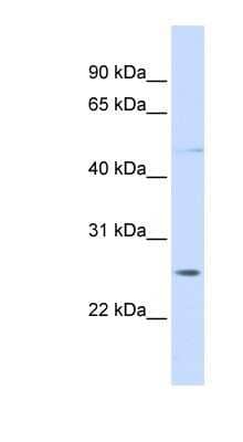 Western Blot: RNF170 Antibody [NBP1-59390] - Titration: 0.2-1 ug/ml, Positive Control: Jurkat cell lysate.