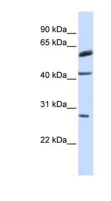Western Blot: RNF170 Antibody [NBP1-59759] - Titration: 0.2-1 ug/ml, Positive Control: MCF7 cell lysate.