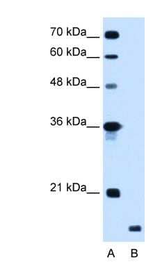 Western Blot RNF175 Antibody - BSA Free