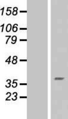 Western Blot: RNF175 Overexpression Lysate (Adult Normal) [NBL1-15436] Left-Empty vector transfected control cell lysate (HEK293 cell lysate); Right -Over-expression Lysate for RNF175.