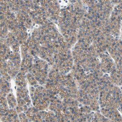 Immunohistochemistry-Paraffin: RNF180 Antibody [NBP1-86127] - Staining of human parathyroid gland shows moderate membranous positivity in glandular cells.