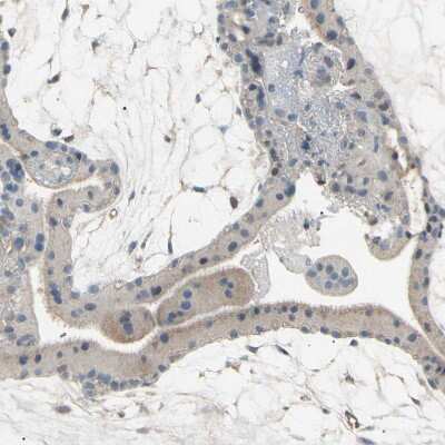 Immunohistochemistry-Paraffin: RNF180 Antibody [NBP1-86127] - Staining of human placenta shows low positivity in trophoblastic cells as expected.