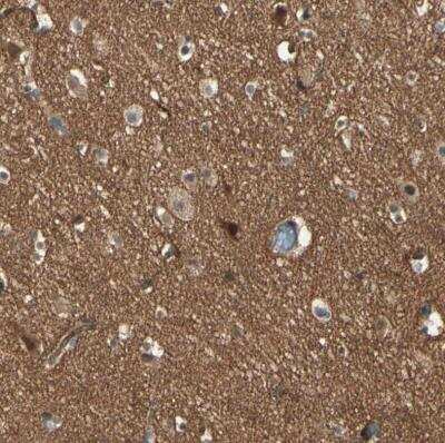 Immunohistochemistry-Paraffin: RNF180 Antibody [NBP1-86127] - Staining of human cerebral cortex shows strong positivity in neuropil.