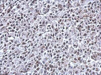 Immunohistochemistry-Paraffin: RNF180 Antibody [NBP2-20179] - Immunohistochemical analysis of paraffin-embedded HBL435 xenograft, using antibody at 1:500 dilution.
