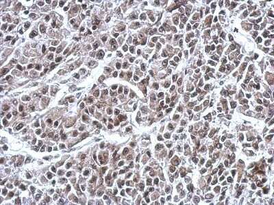 Immunohistochemistry-Paraffin: RNF180 Antibody [NBP2-20180] - Analysis of paraffin-embedded HBL435 xenograft, using antibody at 1:500 dilution.