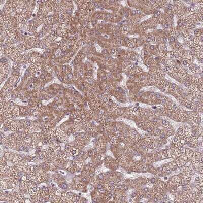Immunohistochemistry-Paraffin RNF181 Antibody - BSA Free