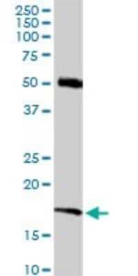 Western Blot RNF181 Antibody - Azide and BSA Free