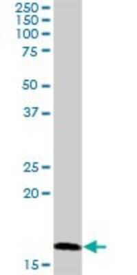 Western Blot RNF181 Antibody - Azide and BSA Free