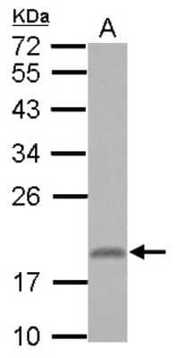 Western Blot: RNF181 Antibody [NBP2-20181] - Sample (30 ug of whole cell lysate) A: Jurkat 12% SDS PAGE gel, diluted at 1:1000.