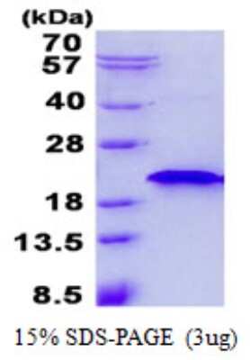 SDS-PAGE Recombinant Human RNF181 His Protein