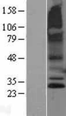 Western Blot RNF182 Overexpression Lysate