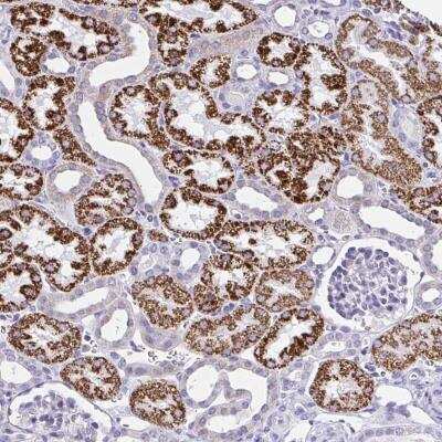 Immunohistochemistry-Paraffin RNF183 Antibody - BSA Free