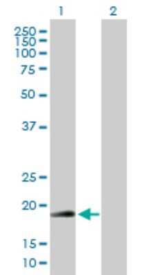 Western Blot: RNF185 Antibody [H00091445-B01P] - Analysis of RNF185 expression in transfected 293T cell line by RNF185 polyclonal antibody.  Lane 1: RNF185 transfected lysate(21.12 KDa). Lane 2: Non-transfected lysate.