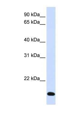 Western Blot: RNF185 Antibody [NBP1-59761] - Human Liver cell lysate, concentration 0.2-1 ug/ml.