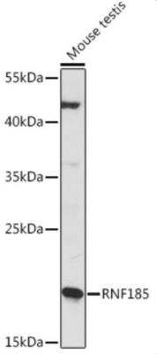 Western Blot: RNF185 Antibody [NBP2-93917] - Western blot analysis of extracts of Mouse testis, using RNF185 at 1:1000 dilution.Secondary antibody: HRP Goat Anti-Rabbit IgG (H+L) at 1:10000 dilution. Lysates/proteins: 25ug per lane. Blocking buffer: 3% nonfat dry milk in TBST. Detection: ECL Basic Kit. Exposure time: 10s.