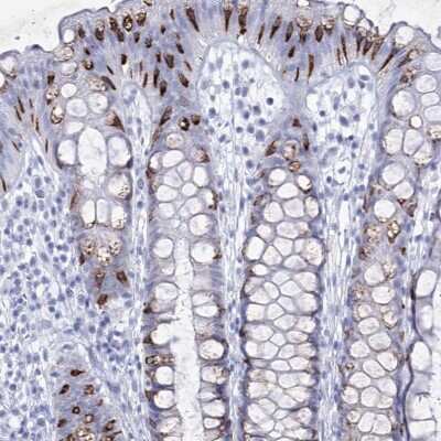Immunohistochemistry: RNF186 Antibody [NBP2-38256] - Staining of human rectum shows strong positivity in goblet cells.