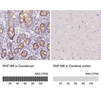 Immunohistochemistry-Paraffin: RNF186 Antibody [NBP1-83667] - Analysis in human duodenum and cerebral cortex tissues. Corresponding RNF186 RNA-seq data are presented for the same tissues.
