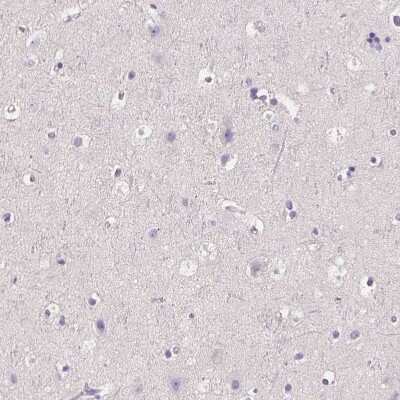 Immunohistochemistry-Paraffin: RNF186 Antibody [NBP1-83667] - Staining of human cerebral cortex shows no positivity in neurons as expected.