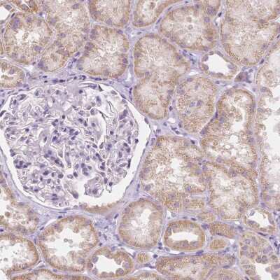 Immunohistochemistry-Paraffin: RNF186 Antibody [NBP1-83667] - Staining of human kidney shows weak cytoplasmic positivity in cells in tubules.