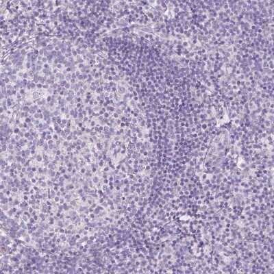 <b>Orthogonal Strategies Validation. </b>Immunohistochemistry-Paraffin: RNF186 Antibody [NBP1-83667] - Staining of human lymph node shows no positivity in non-germinal center cells as expected.