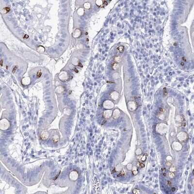 Immunohistochemistry-Paraffin: RNF186 Antibody [NBP2-38256] - Staining of human duodenum shows high expression.