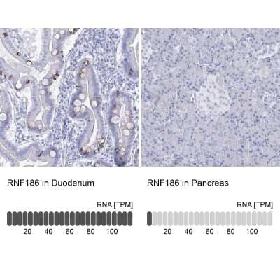 <b>Orthogonal Strategies Validation. </b>Immunohistochemistry-Paraffin: RNF186 Antibody [NBP2-38256] - Staining in human duodenum and pancreas tissues using anti-RNF186 antibody. Corresponding RNF186 RNA-seq data are presented for the same tissues.