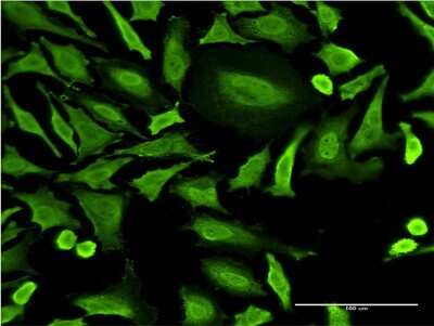 Immunocytochemistry/Immunofluorescence: RNF2 Antibody (2B6) [H00006045-M05] - Analysis of monoclonal antibody to RNF2 on HeLa cell. Antibody concentration 10 ug/ml