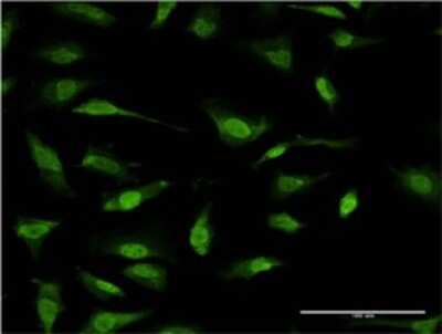 Immunocytochemistry/Immunofluorescence: RNF2 Antibody (3B8) [H00006045-M08] - Analysis of monoclonal antibody to RNF2 on HeLa cell. Antibody concentration 10 ug/ml