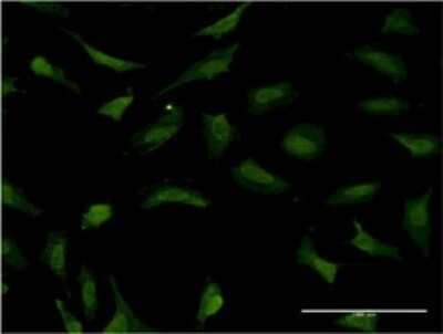 Immunocytochemistry/Immunofluorescence: RNF2 Antibody (3G6) [H00006045-M03] - Analysis of monoclonal antibody to RNF2 on HeLa cell. Antibody concentration 10 ug/ml