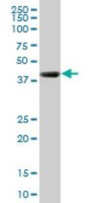 Western Blot: RNF2 Antibody (3G6) [H00006045-M03] - Analysis of RNF2 expression in human stomach.