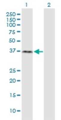 Western Blot: RNF2 Antibody (3G6) [H00006045-M03] - Analysis of RNF2 expression in transfected 293T cell line by RNF2 monoclonal antibody (M03), clone 3G6. Lane 1: RNF2 transfected lysate (Predicted MW: 36.52 KDa). Lane 2: Non-transfected lysate.