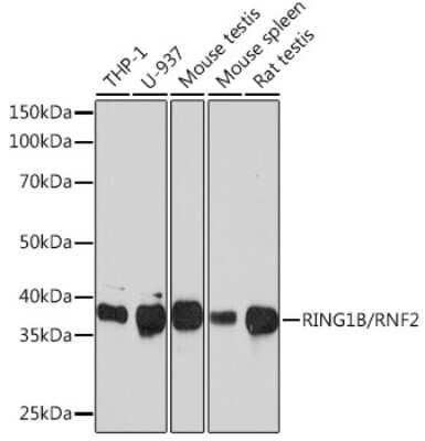 Western Blot: RNF2 Antibody (9Q2W2) [NBP3-16222] - Western blot analysis of extracts of various cell lines, using RNF2 Rabbit mAb (NBP3-16222) at 1:1000 dilution. Secondary antibody: HRP Goat Anti-Rabbit IgG (H+L) at 1:10000 dilution. Lysates/proteins: 25ug per lane. Blocking buffer: 3% nonfat dry milk in TBST. Detection: ECL Basic Kit. Exposure time: 3min.