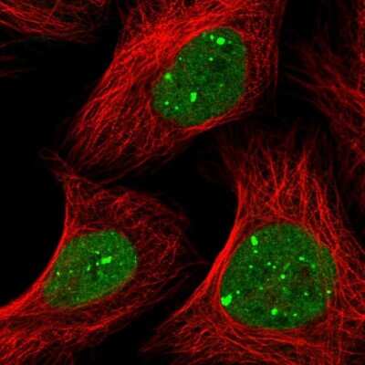 Immunocytochemistry/Immunofluorescence: RNF2 Antibody [NBP1-88712] - Immunofluorescent staining of human cell line U-2 OS shows localization to nuclear bodies.